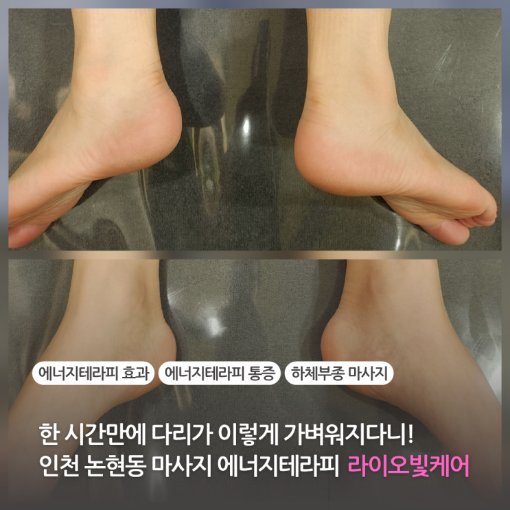  인천논현동마사지 에너지테라피로 하체부종 싹 뺀 후기 인천에스테틱 라이오빛케어