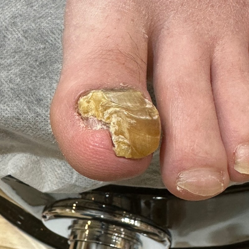 대전 문제성 발톱 전문숍에서 함께 관리해요!!