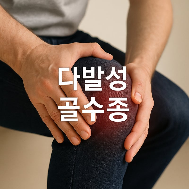 다발성골수종 증상, 골수암 놓치기 쉬운 신호는?