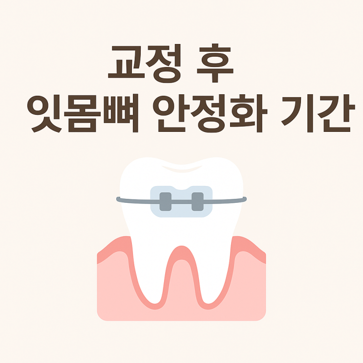   교정 후 잇몸뼈 안정화 기간