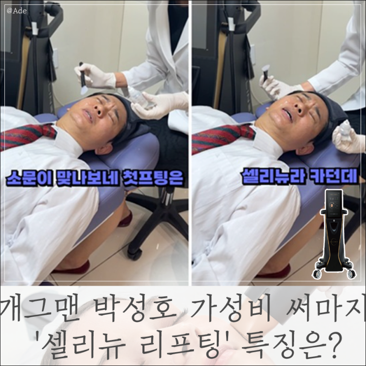 <b>개그맨</b> <b>박성호</b> 가성비 써마지 '셀리뉴 리프팅' 가격 부작용... 