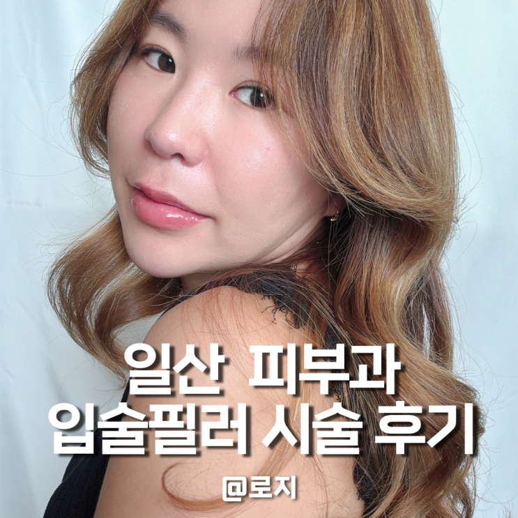  일산 쥬브겔 입술필러 내돈내산 시술 후기