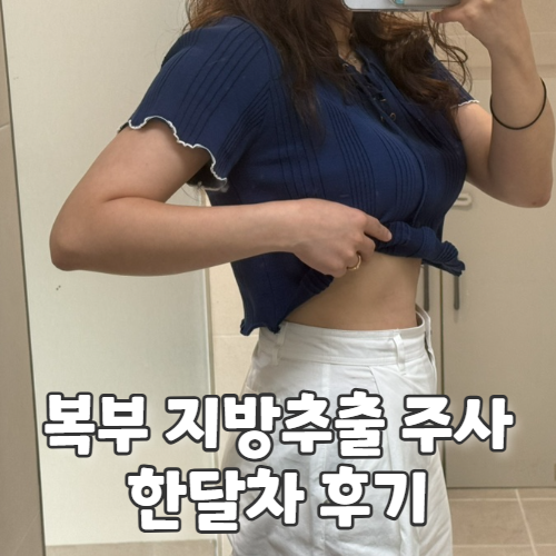  복부 지방추출주사 매일 달라지는 효과멍붓기 부작용 찐후기