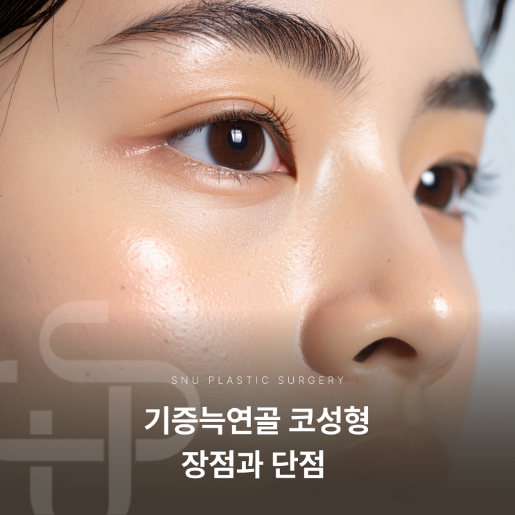  기증늑연골 코성형 장점과 단점