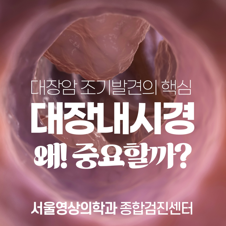  경안동대장내시경, 대장암 조기 발견과 예방을 위한 필수 선택
