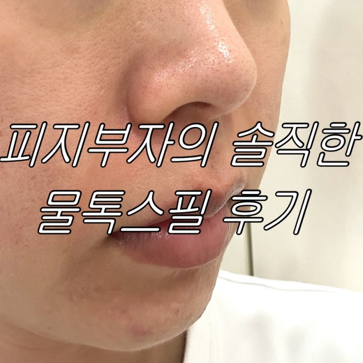 내돈내산 | 민감성 예민한 피부의 물톡스필 필링 솔직 후기