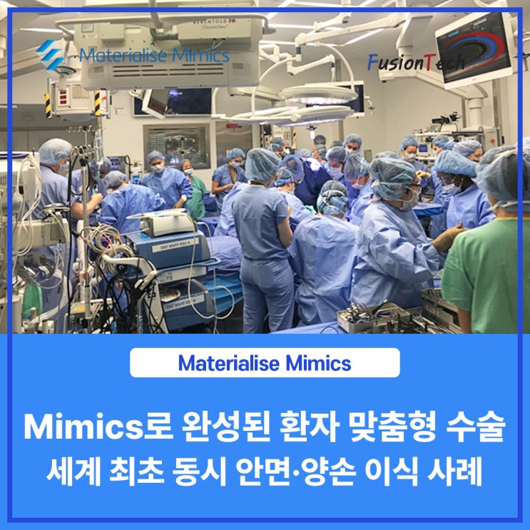  [Materialise S/W] Mimics로 완성된 환자 맞춤형 수술 - 세계 최초 동시 안면·양손 이식 사례