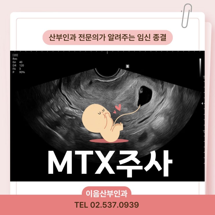  MTX주사 종결 임신 5주차 자궁내 정상 임신
