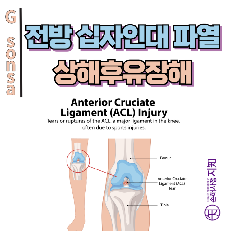  전방 십자인대 파열 후유장해 인정 기준, 5mm 차이가 수백만 원 차이 난다고요? - [보험금, BA+DA]