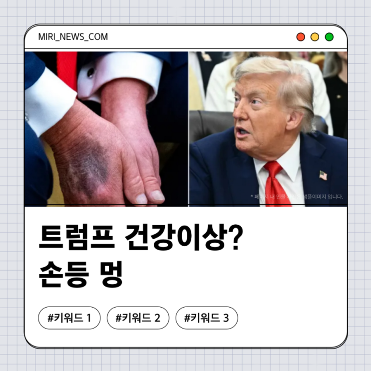  트럼프 국방부 관련 발표, 손등 멍 사진 공개이후…주식 투자자들 주목