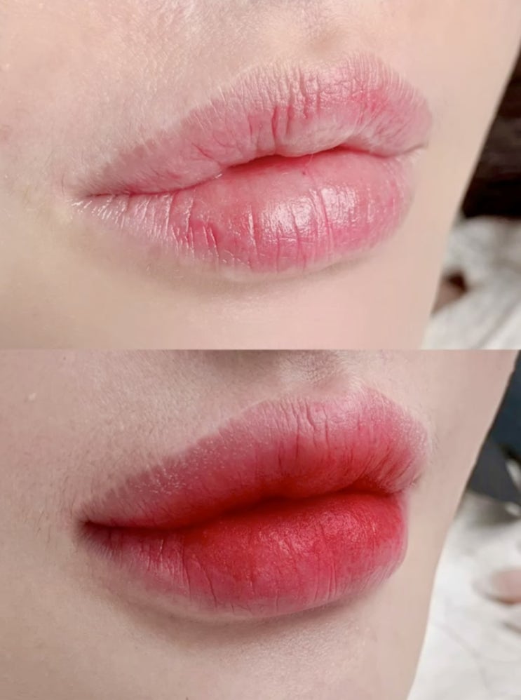  입술 반영구 시술 전후 변화와 메디컬 타투 전문 센터 소개