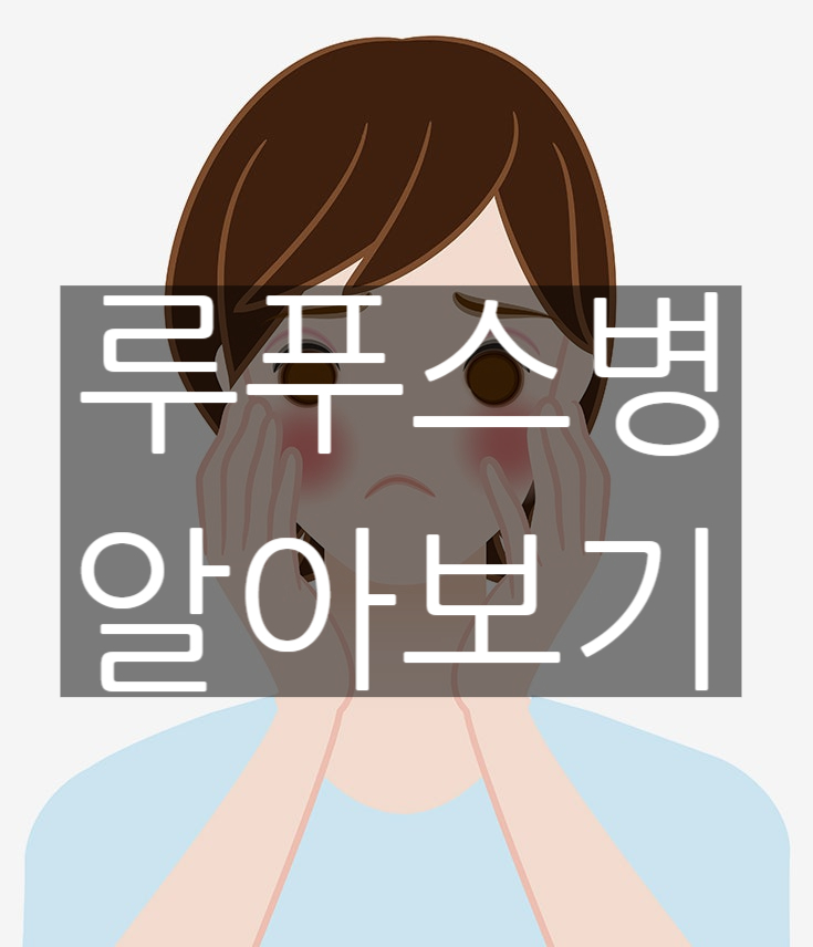 루푸스병이란? 증상, 원인, 치료 방법 알아보기