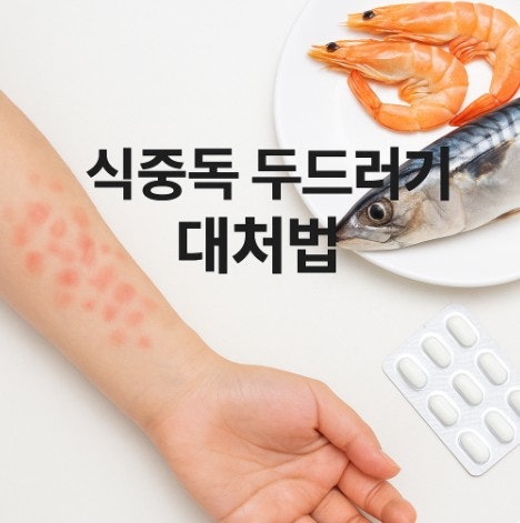 식중독 두드러기 구분·대처법