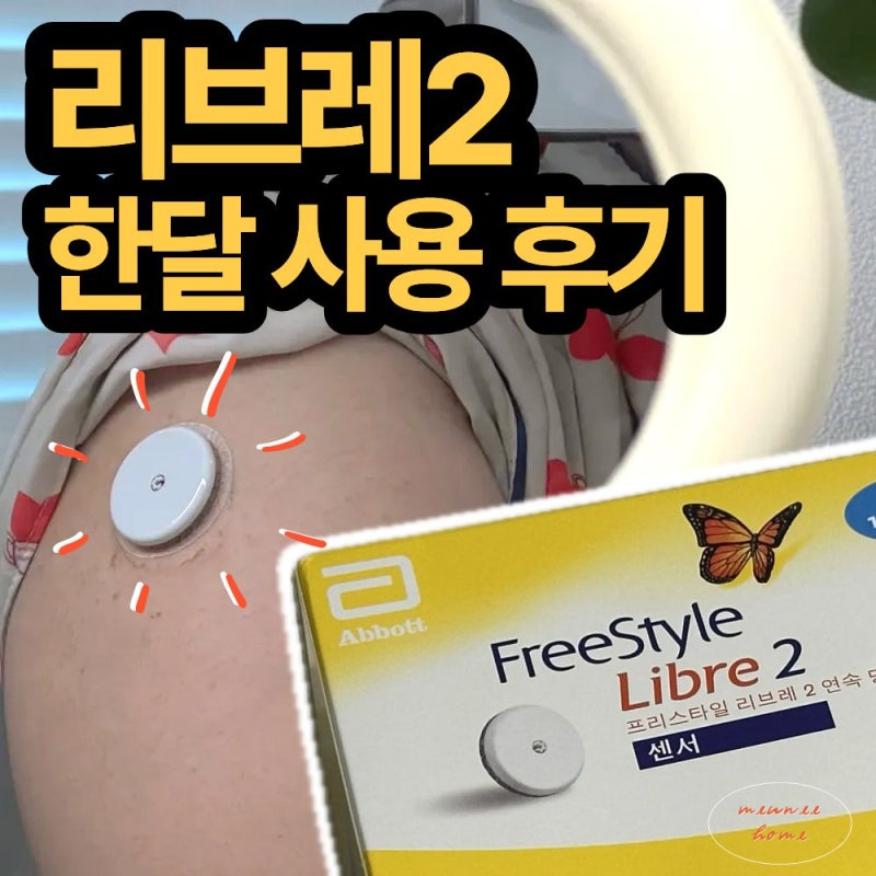 리브레2 한 달 사용 후기 | 정확도, 불편함, 비용까지 솔직 리뷰