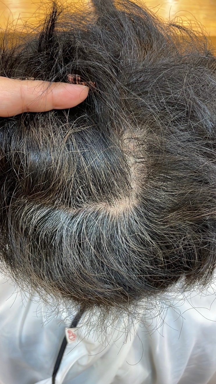  남자극손상곱슬헤어 복구볼륨매직으로 환골헤어스토리 부산사상르네시떼미용실/ 괘법감전주례학장구덕하단김해화명덕천덕포서면부전부암범일양정초량문현범천대연광안수영망미해운대센텀기장장유