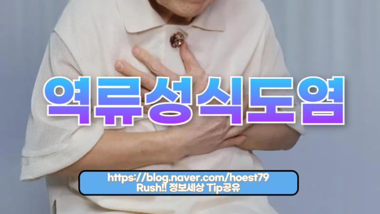  역류성식도염 예방 음식, 올바른 식습관으로 건강 지키는 법