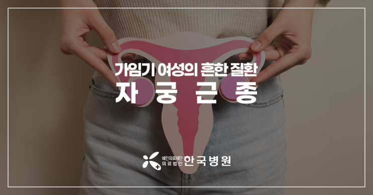  제주 산부인과_자궁근종, 흔한 만큼 증상, 관리, 치료법 잘 알아야