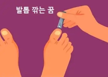  발톱 깎는 꿈 뽑는 꿈 발톱 깨지는 꿈 발톱깍아주는꿈 해몽