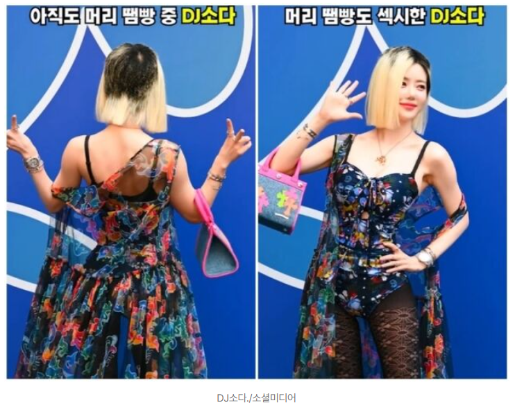   DJ소다, 탈색 피해 후 당당한 근황 공개