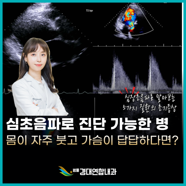  심장초음파로 알 수 있는 질병 5가지, 이상 신호를 놓치지 마세요