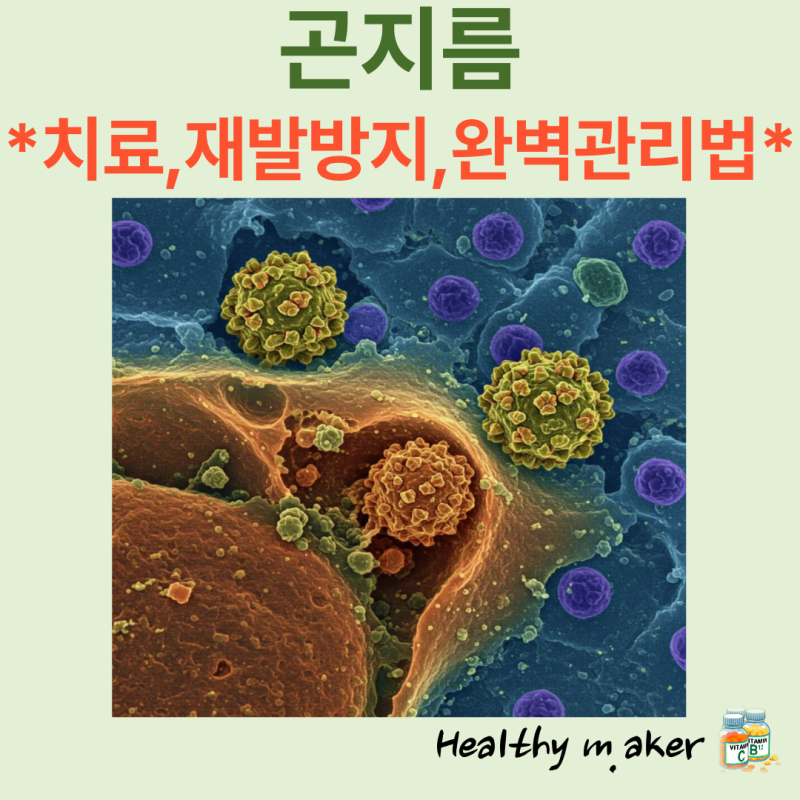 곤지름 치료부터 재발 방지까지, 완벽 관리법 공개