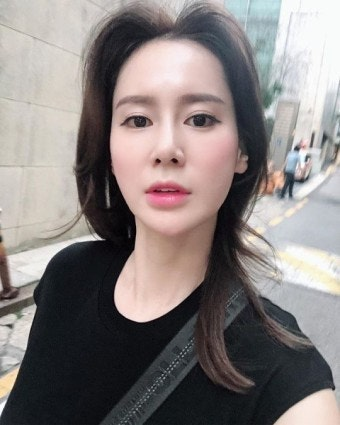 안정환 아내 이혜원, 낙상 부상에도 저녁 약속 지킨 근황…남편의 든든한 돌봄까지