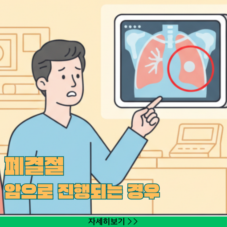  폐결절 암으로 진행되는 경우, 50대 이상 흡연자가 반드시 알아야 할 5단계 자가진단법