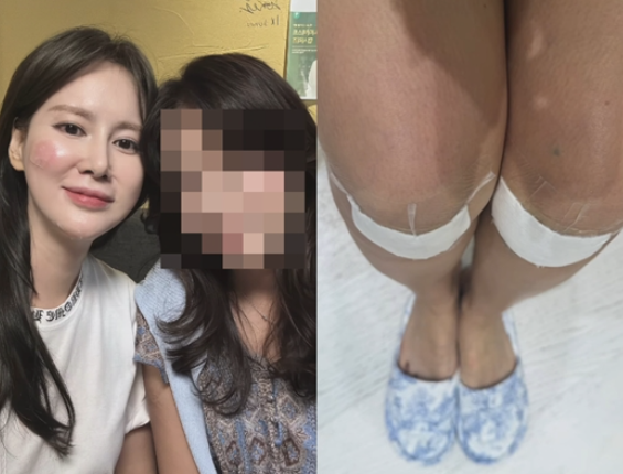  이혜원, 부상에도 저녁 약속 지킨 근황 “안느(안정환)가 두 손 들었다”
