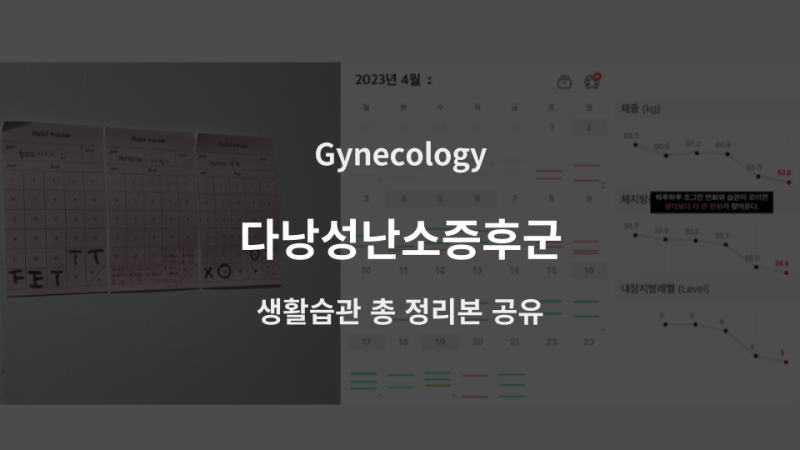 [한의사 작성] 다낭성난소증후군, 생활습관 이렇게만 하세요!! (비만 다이어트 식단, 탄수화....