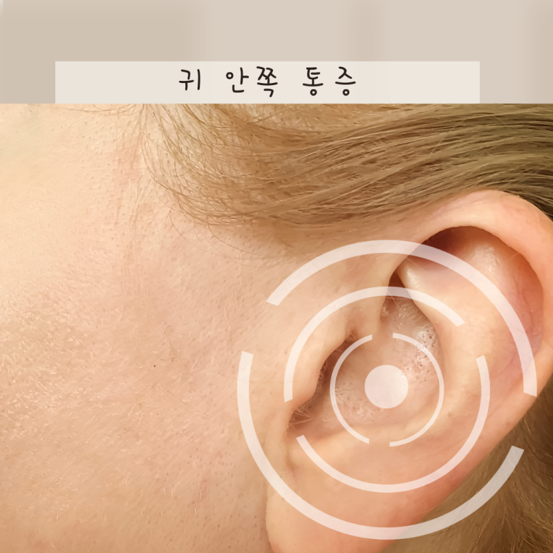 오른쪽 왼쪽 귀 안쪽 통증 원인! 대처법과 병원 가야 하는 상황까지 총정리