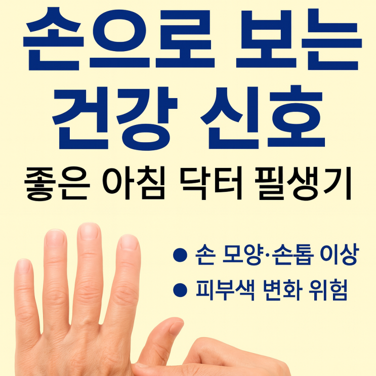  좋은 아침 닥터 필생기에서 배운  손 모양,손톱,색이 말하는 정맥류·류머티즘·심혈관 질환
