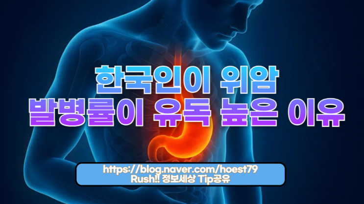  한국인이 위암 발병률이 유독 높은 이유