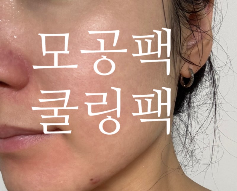 로이아웰 핑크 쿨링팩 모공팩 각질케어까지 한번에 홍조인분들에게 추천