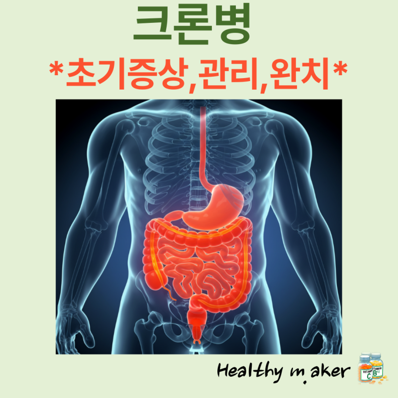 크론병 초기증상부터 관리까지: 완치를 향한 여정