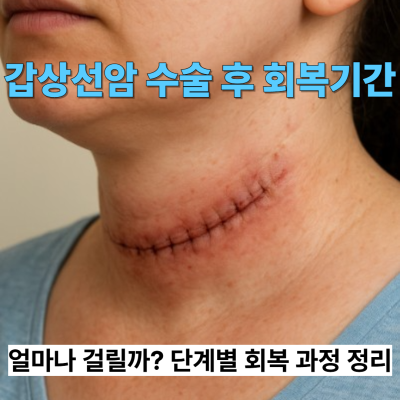 갑상선암 수술 후 단계별 회복 기간과 관리 방법