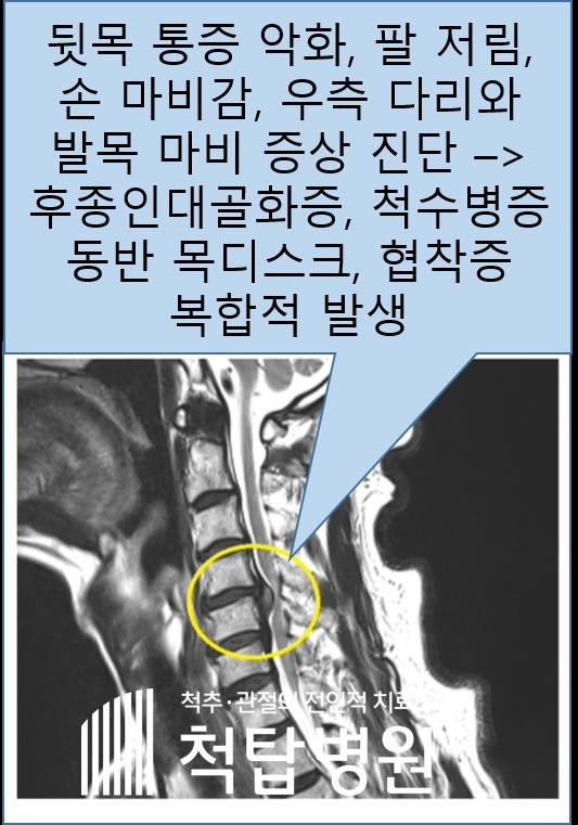 대구 목 디스크 병원 이런 곳은 주의하세요!