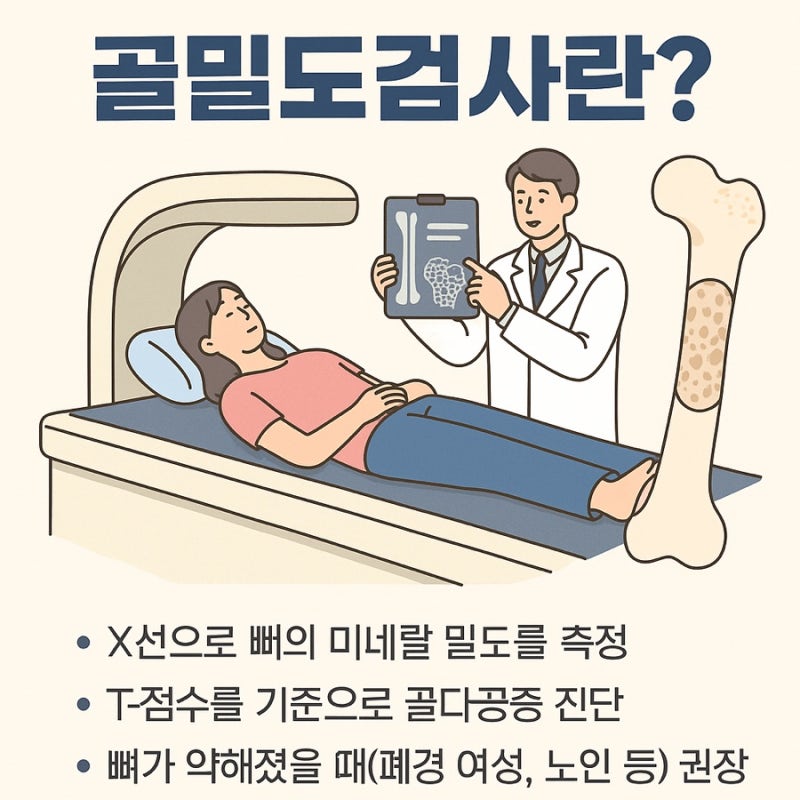 골밀도검사(BMD) 정상수치부터 비용, 금식 여부까지