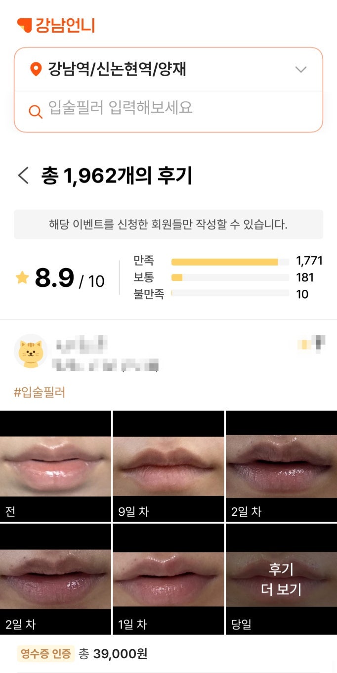  서초 입술필러, 강남언니 후기 2000건이 증명하는 2가지 차이점