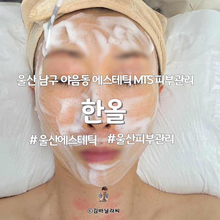  울산에스테틱 한올 mts 리베룩 환절기 피부 관리