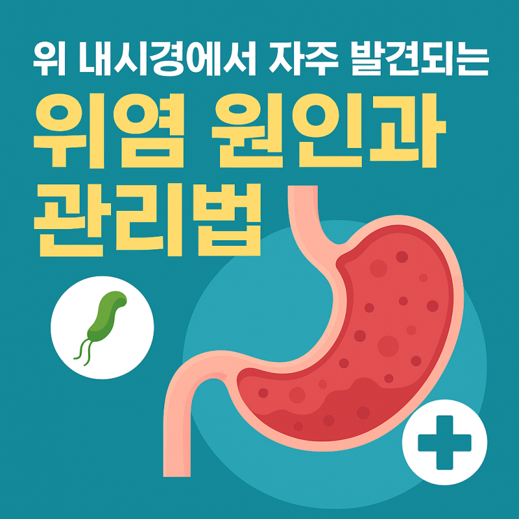  위 내시경에서 자주 발견되는 위염 원인과 관리법