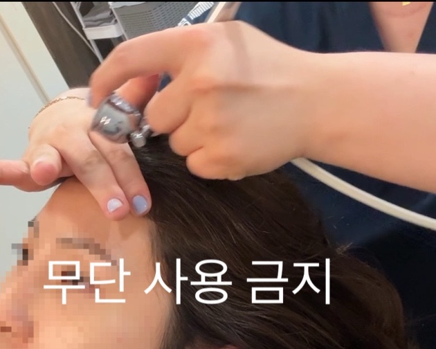  부산모발이식 탈모치료 병원 상담 및 스케일링 후기