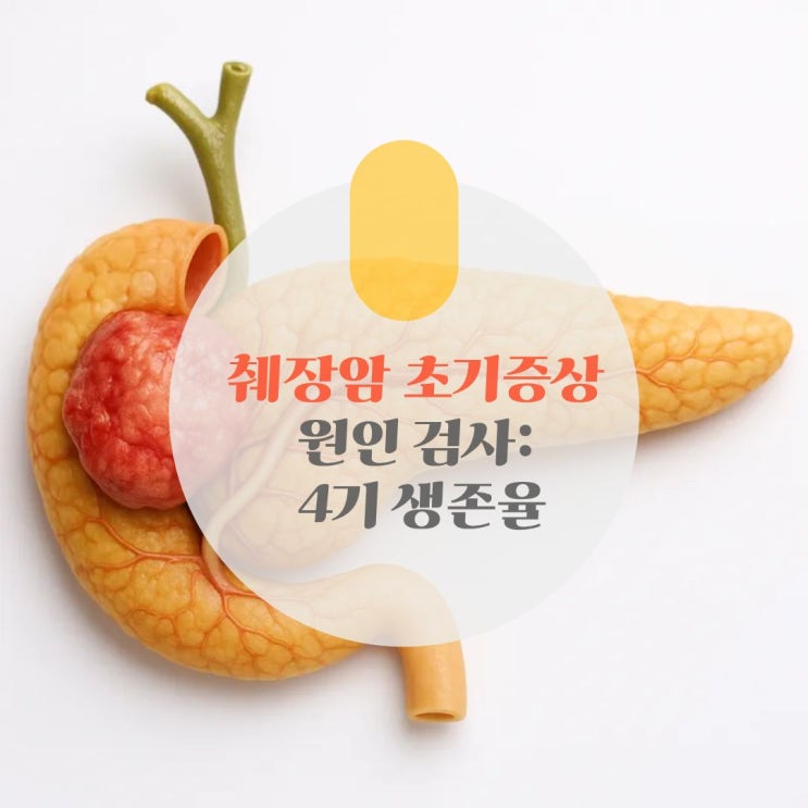 췌장암 초기증상 원인 검사: 4기 <b>생존율</b>