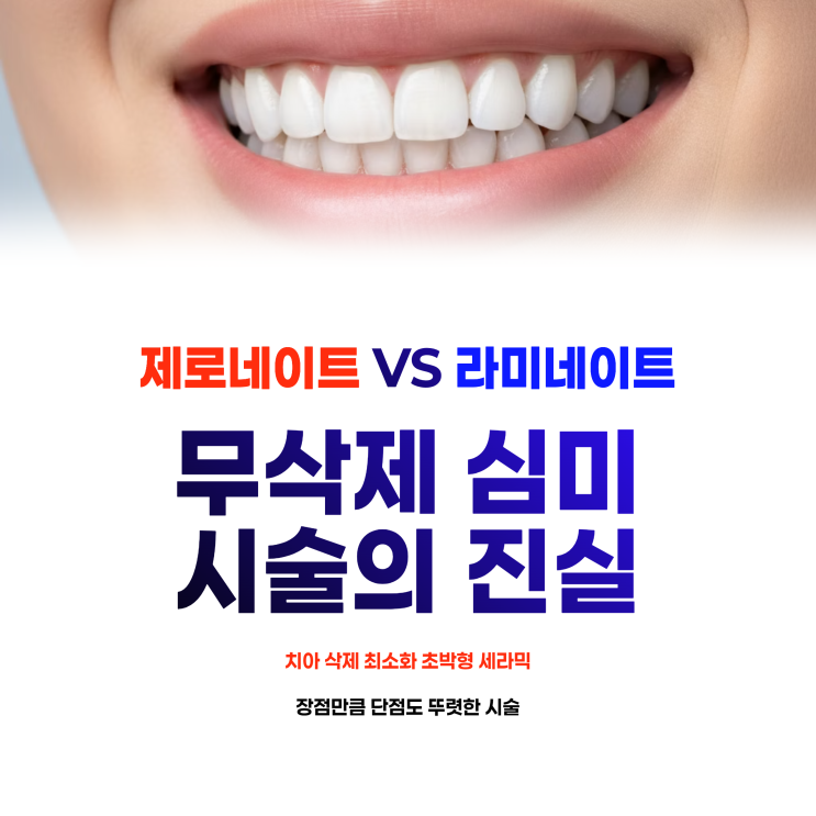  제로네이트 뜻 라미네이트 비교 부작용 후기와 관리 방법 총정리