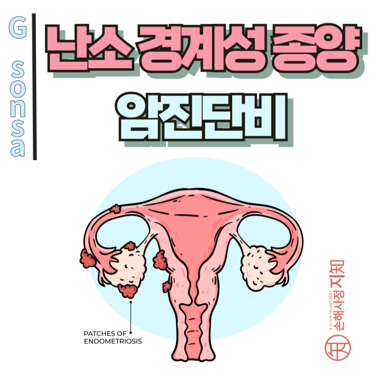  난소 경계성 종양 암진단비 분쟁, 가입 시기에 따라 달라지는데 증권은 보셨어요? - [보험금, BA+DA]