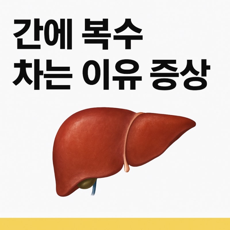 간경화 복수 차는 증상 차는 이유 증상 반드시 체크하세요