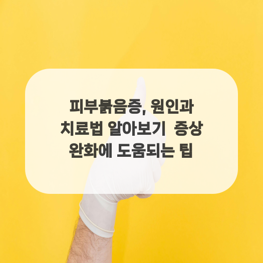  피부붉음증, 원인과 치료법 알아보기  증상 완화에 도움되는 팁