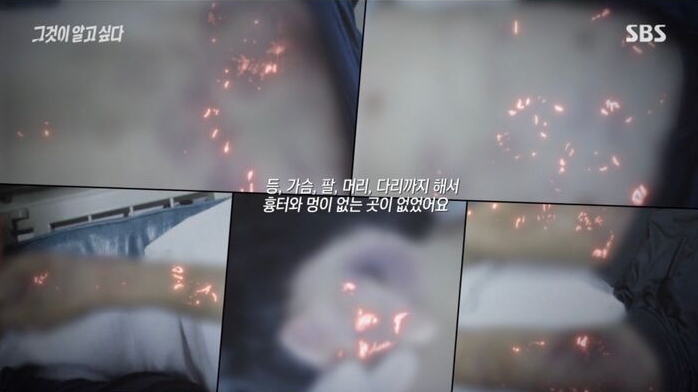  '그알 재조명' 부산 17세 소년, 3년간 학대 사망…친모 폭행·이웃 방조 실체