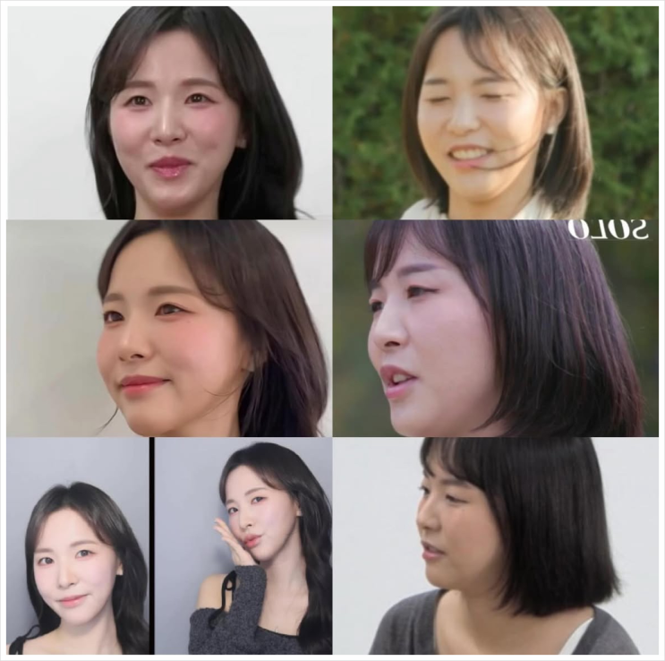  24기 순자 올타이트 리프팅? 이런분들께 추천
