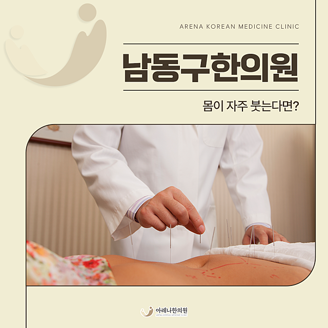 남동구한의원 몸이 자주 붓는다면?