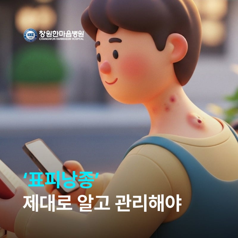 창원한마음병원 성형외과 장석주 교수, ‘표피낭종’ 제대로 알고 관리해야